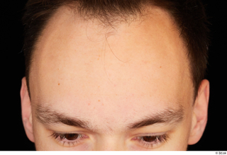 Johnny Reed forehead head 0001.jpg